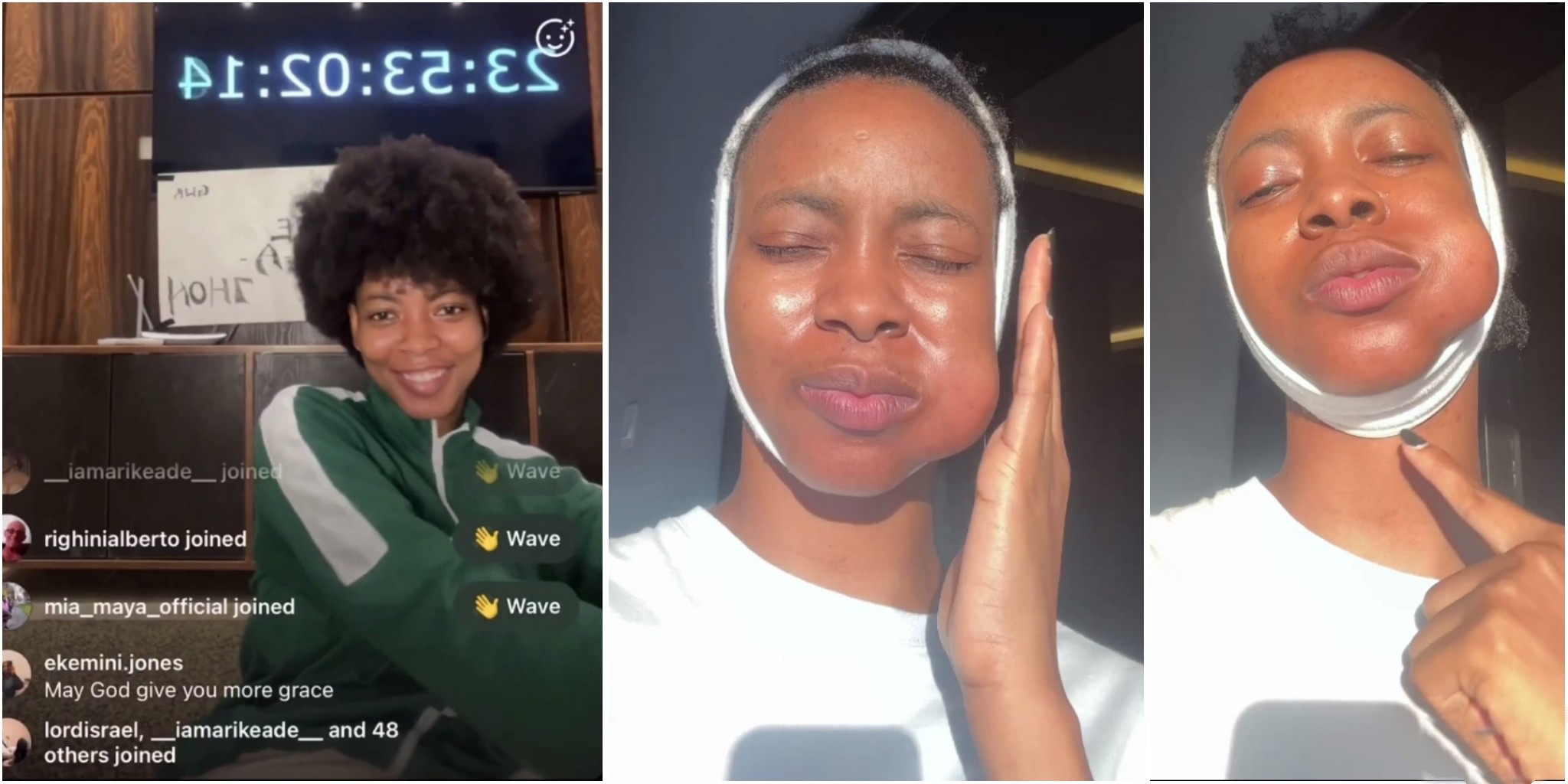 Nigerian lady diagnosed with long chin syndrome after completing 72-hour smile-a-thon contest (VIDEO)