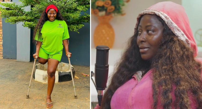 How I make photos, videos of myself in skimpy outfit and get paid – amputee actress, Doris Akonanya [VIDEO]