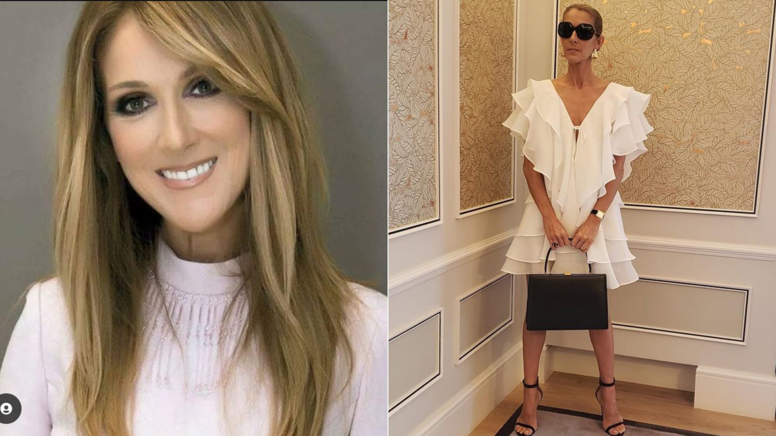 Celine Dion losts control of muscles due to Stiff -Person Syndrome.