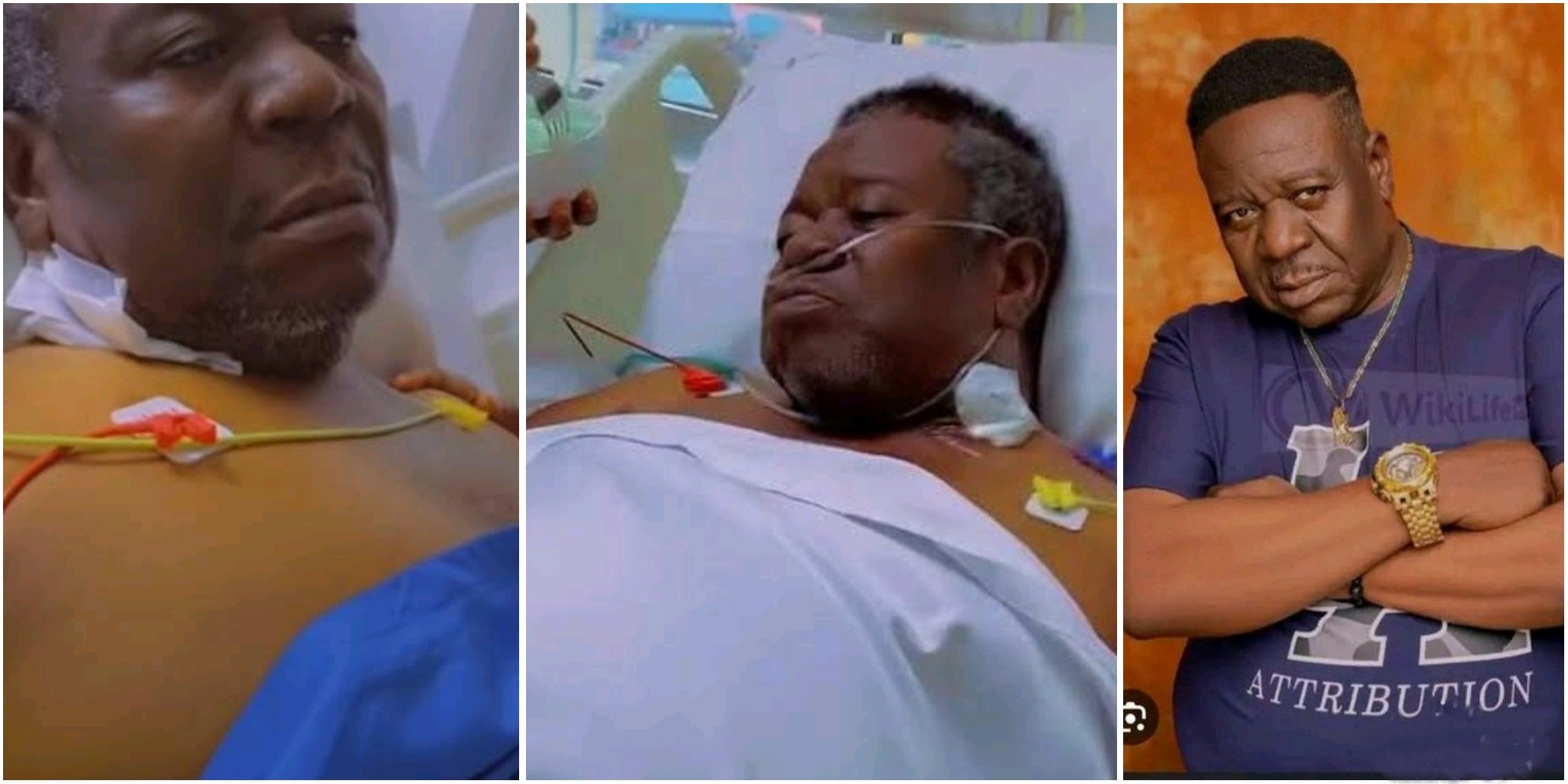 Mr. Ibu reportedly undergoes another leg surgery, hardly talks again