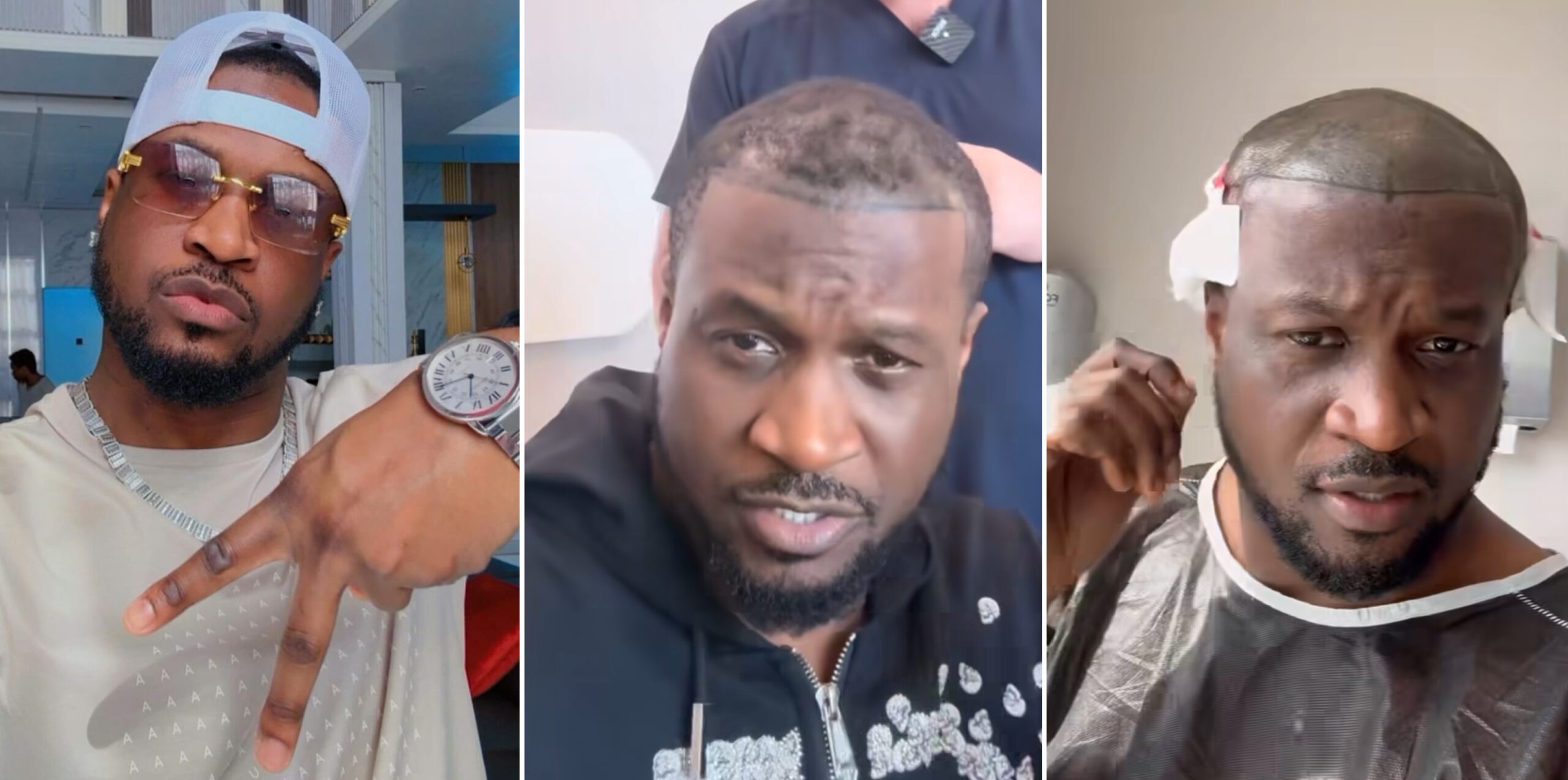 "Bald is Beautiful, But New Hair Ain't a Crime": Nigerians React to Peter Okoye's Hair Transplant!