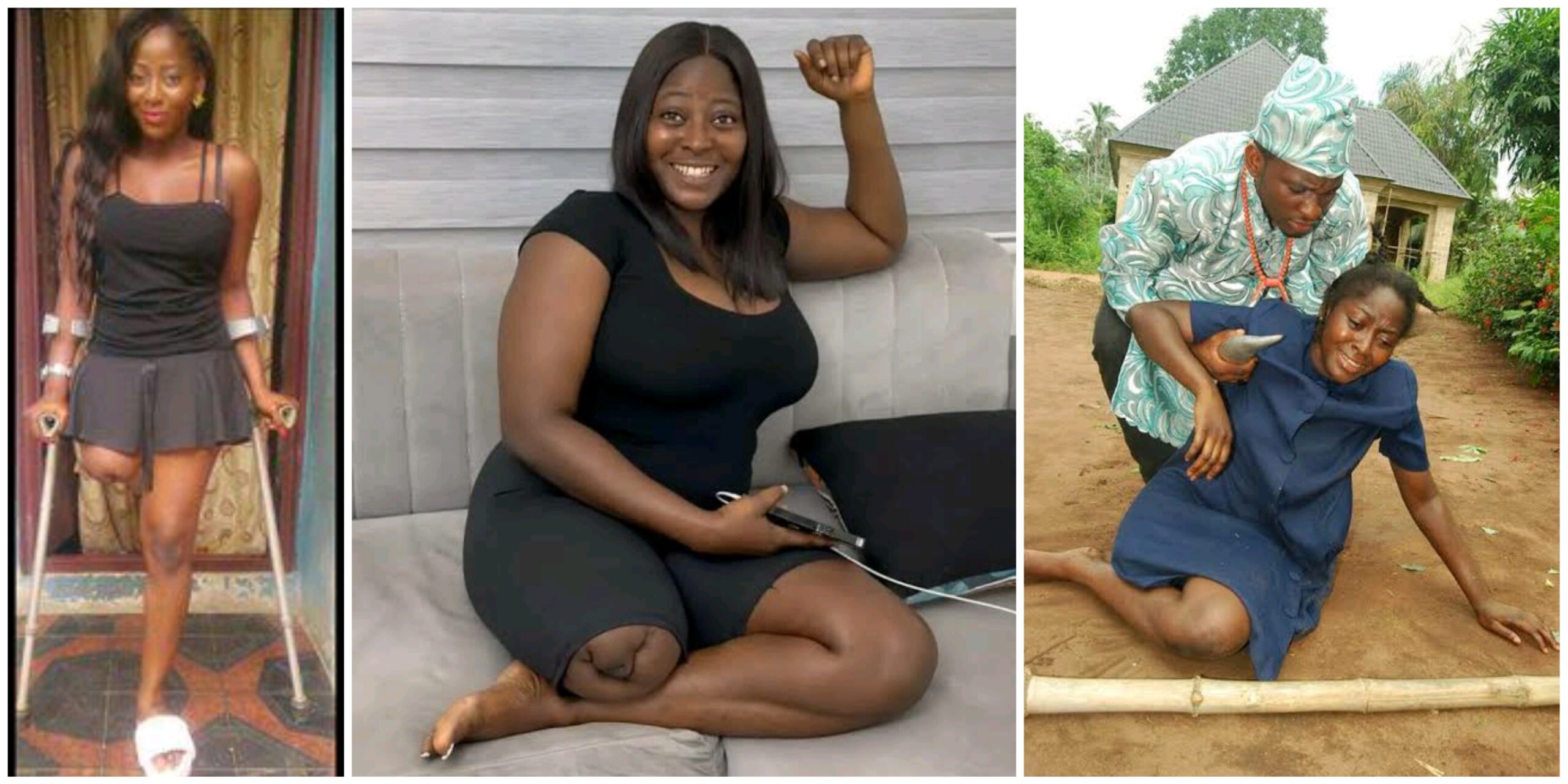 “I wasn’t born this way,” Actress Doris Akonanya, in new video, reveals how she lost one leg