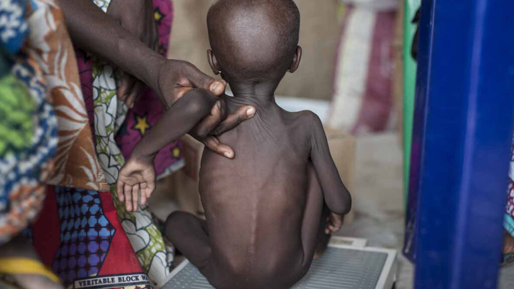 FG Moves To Tackle Malnutrition