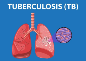 Tuberculosis