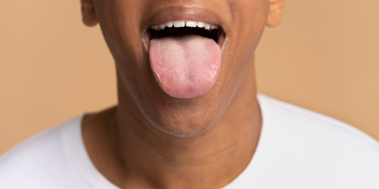 Why Does the Tip of My Tongue Hurt?