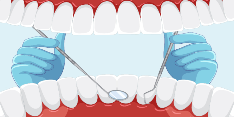 What is Gingivitis