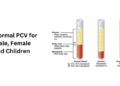 Normal PCV for Male, Female and Children