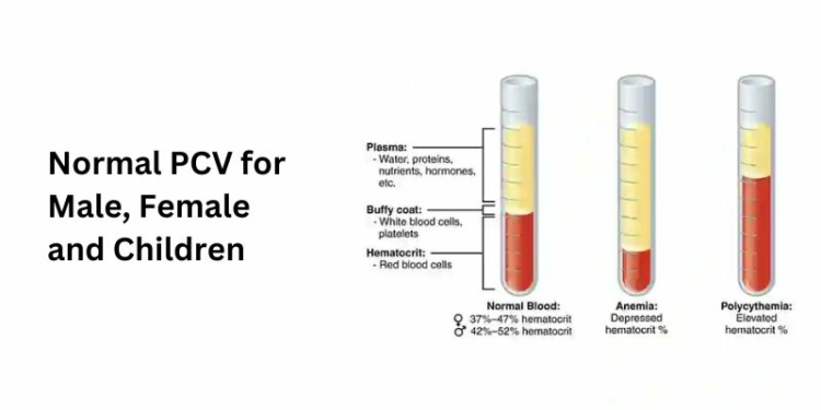 Normal PCV for Male, Female and Children