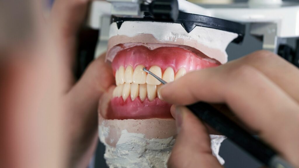 Occlusion - An Overview of Dental Anatomy