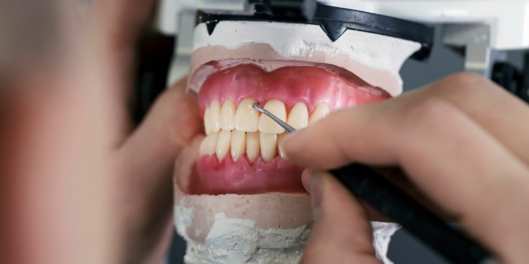 Occlusion - An Overview of Dental Anatomy