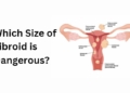 Which Size of Fibroid is Dangerous?