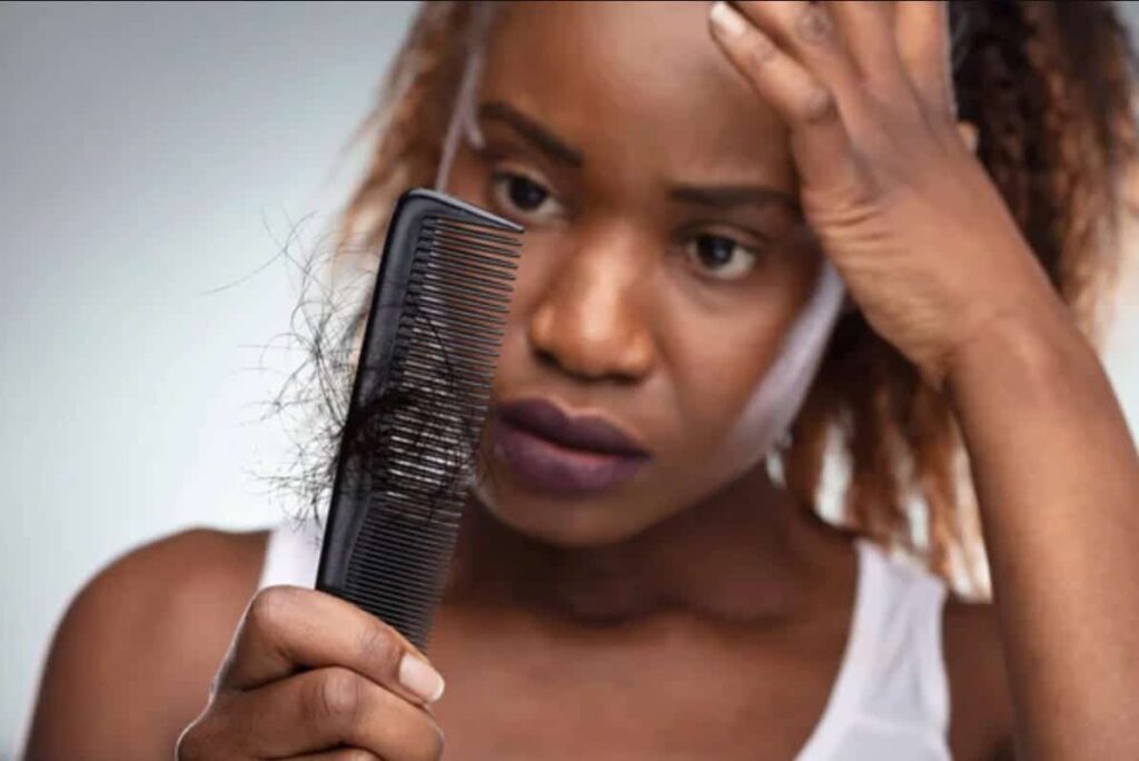 How To Prevent Hair Fall And Tips To Control It