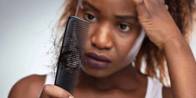 How To Prevent Hair Fall And Tips To Control It