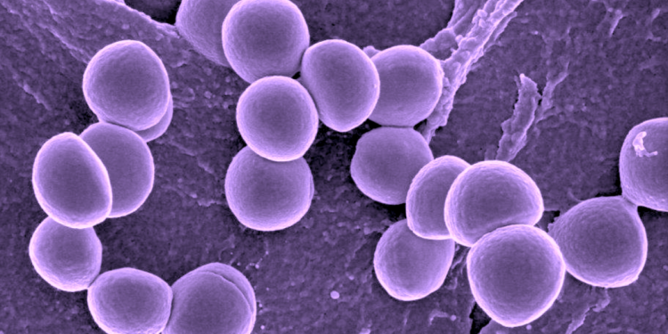 Staphylococcus Aureus