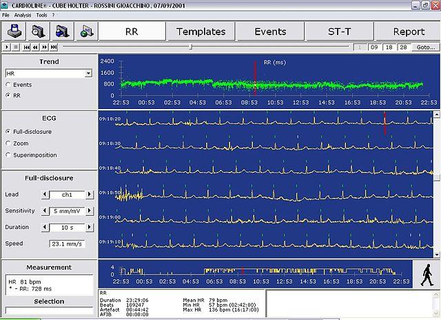 Example of Hybrid Computer