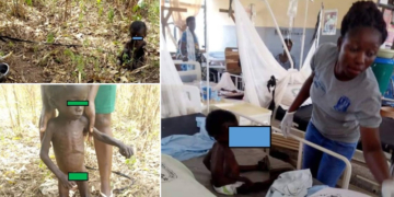 Boy Tied To A Tree And Fed Like An Animal By Grandmother, Rescued