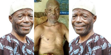 Veteran Yoruba Actor, Alabi Yellow, Dying Of Stroke