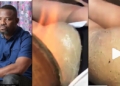 Okey Bakassi reacts to butt enlargement