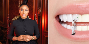 Tonto Dikeh, Teeth whitening [Image for depiction purpose only]