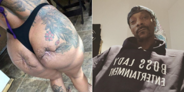 L-R: Lady's butt scarred by cosmetic surgery,  Snoop Dogg