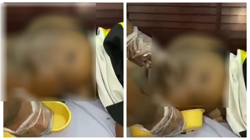 BOTCHED PLASTIC SURGERY: Disturbing video shows woman screaming out in pain as fat leaks out of her butt