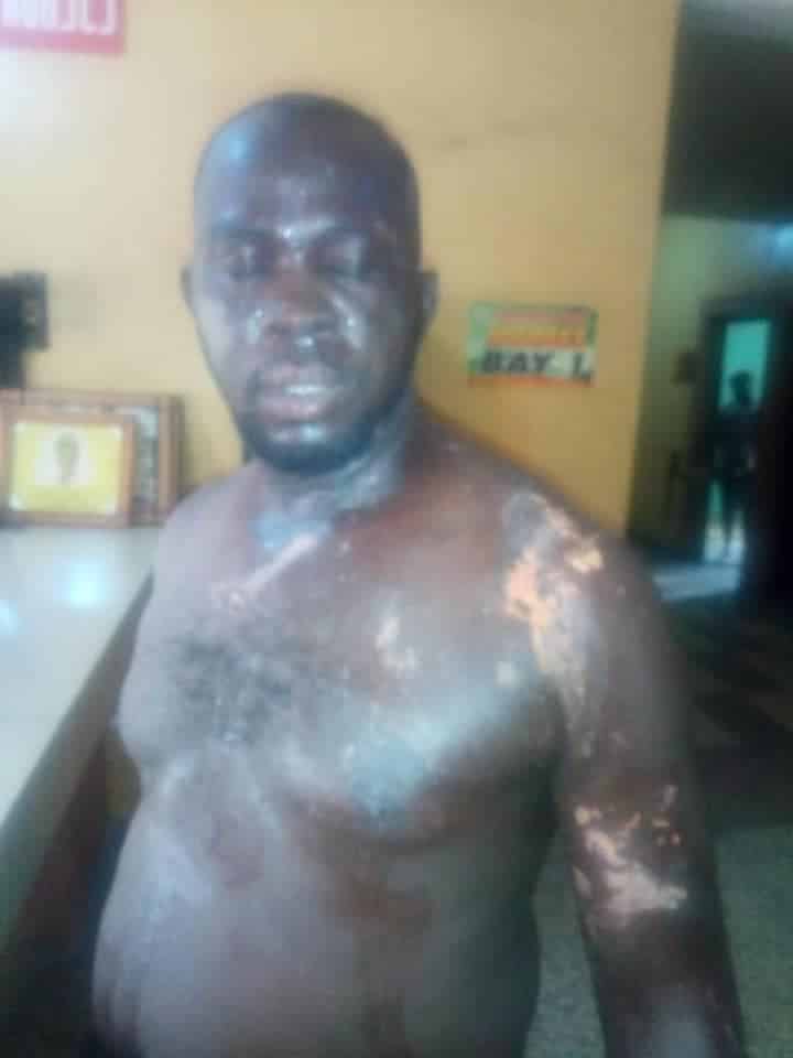 Angry youths bath Policemen with ‘acid’ to avenge death of man shot in Anambra state