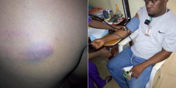 Coronavirus lockdown: NTA staff allegedly brutalized by soldiers in Ondo