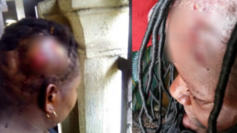 PHOTOS: Nigerian man flees after breaking his wife's head with pestle