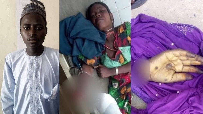 PHOTO: 22-year-old man arrested for cutting off wife's hand in Yobe