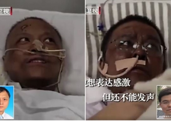 Photos: Chinese doctors who were critically ill with COVID-19 wake up to find that their skin has turned dark