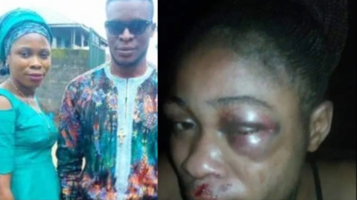 33-year-old pregnant woman allegedly brutalized by her husband for refusing to abort her pregnancy