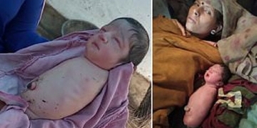 Baby Girl Born With No Arms or Legs Leaves Doctors Baffled