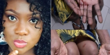 Mother of two narrates how her gateman strangled her with a rope and demanded N30m