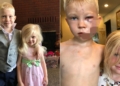 Boy left with 90 stitches after risking own life to save sister from dog attack