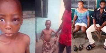 Couple arrested for allegedly torturing 8-year-old boy over N100 akara in Imo