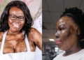 South African lady narrates how her husband poured petrol and set her ablaze during an argument